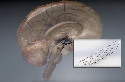 Учени разработват изкуствен гръбначен мозък (видео)