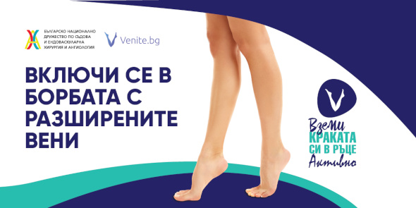 Жените са по-засегнати, но и много по-загрижени от мъжете за профилактиката на хроничната венозна болест